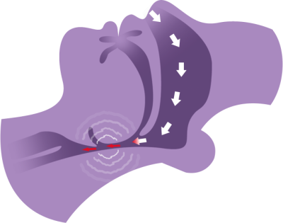 What is the difference between snoring and obstructive sleep apnea?